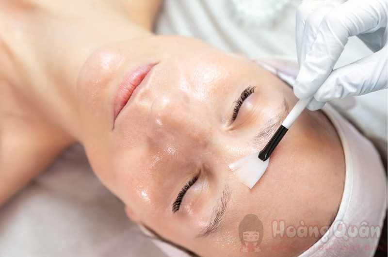 nguyên nhân peel da bị thâm