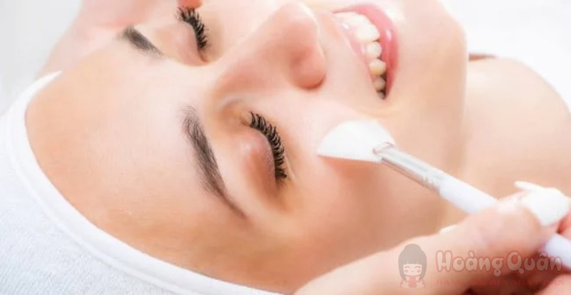 tăng sắc tố da sau peel