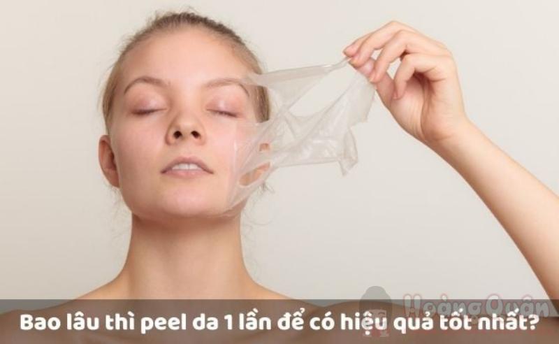 bao lâu peel da 1 lần