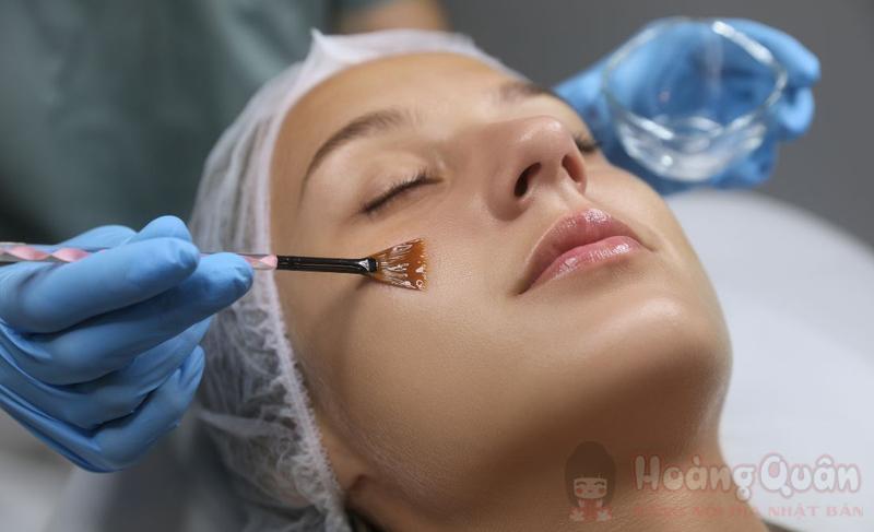 peel da bao lâu thì sẽ đẹp