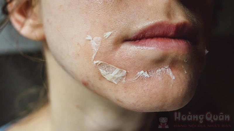 các bước peel da