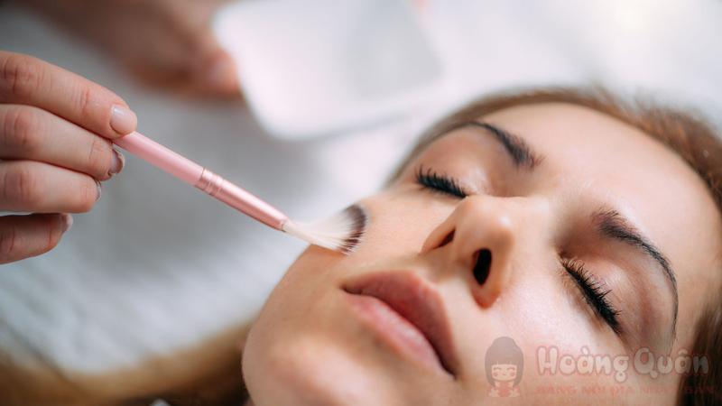 phục hồi da sau peel