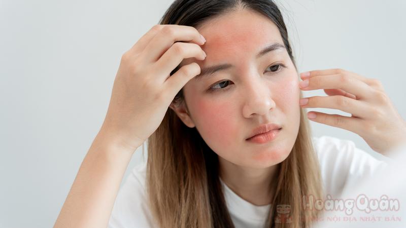 dấu hiệu sau khi peel da