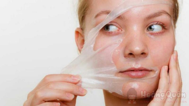 peel da có hết mụn không