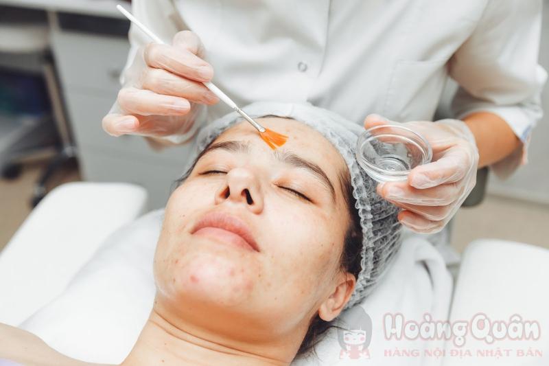 cách peel da trị thâm mụn