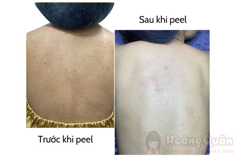 cách peel da body tại nhà