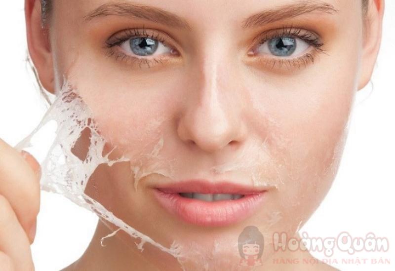 ai nên peel da trị nám