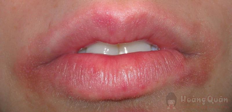 hạn sử dụng của son dưỡng môi​ bao lâu