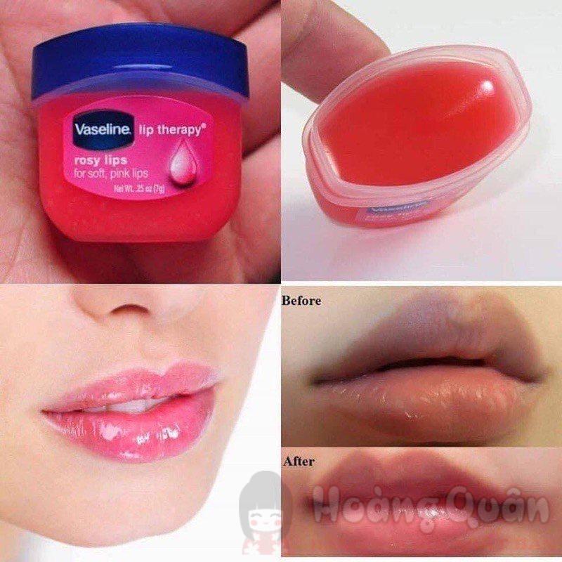 giải đáp son dưỡng vaseline có trị thâm môi không