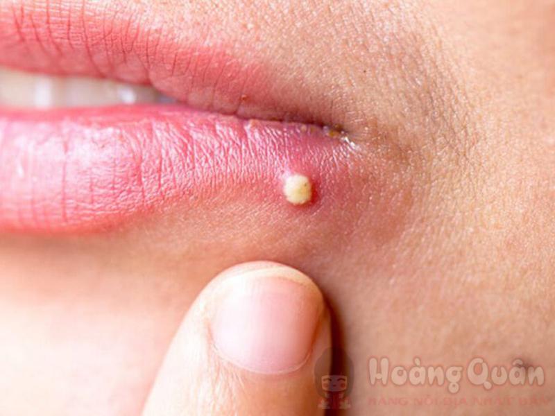 tìm hiểu những tác hại của son dưỡng môi