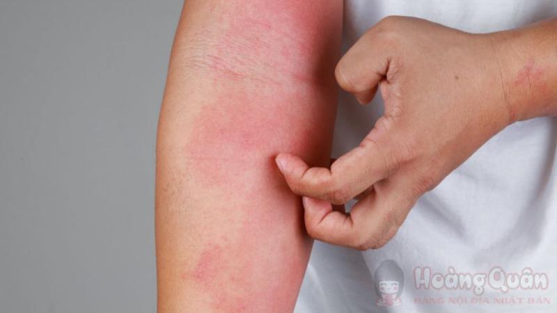 những tác dụng phụ của tảo xoắn Nhật Bản