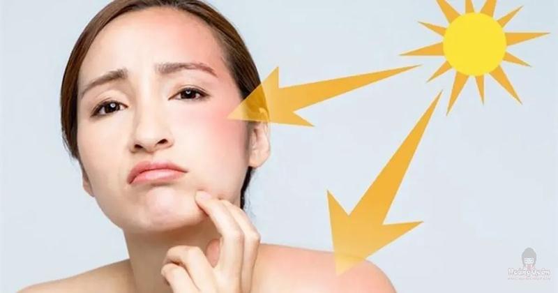 trước khi bôi kem chống nắng cần làm gì