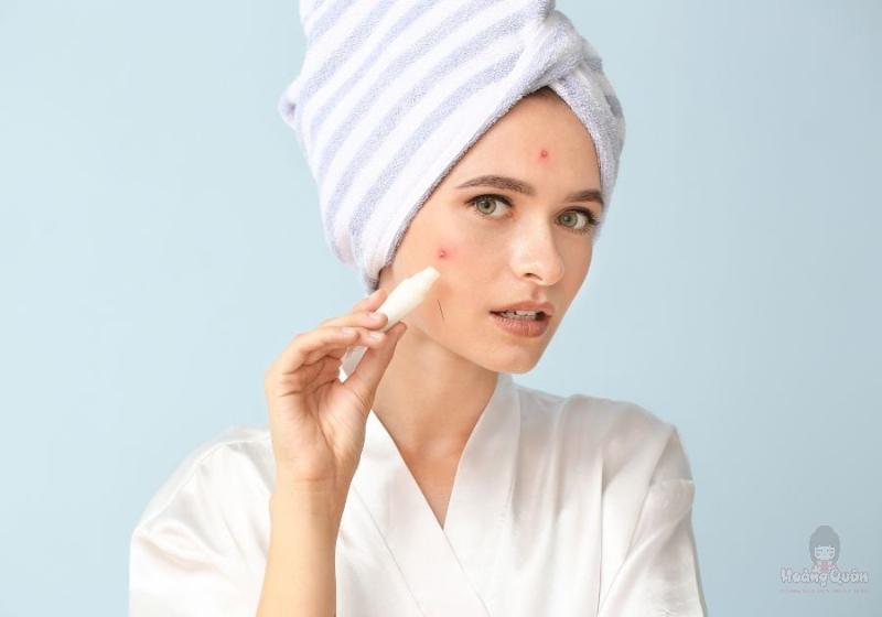 bôi kem trị mụn trước hay sau kem chống nắng