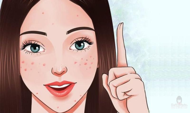 giải đáp da mụn có nên dùng kem chống nắng