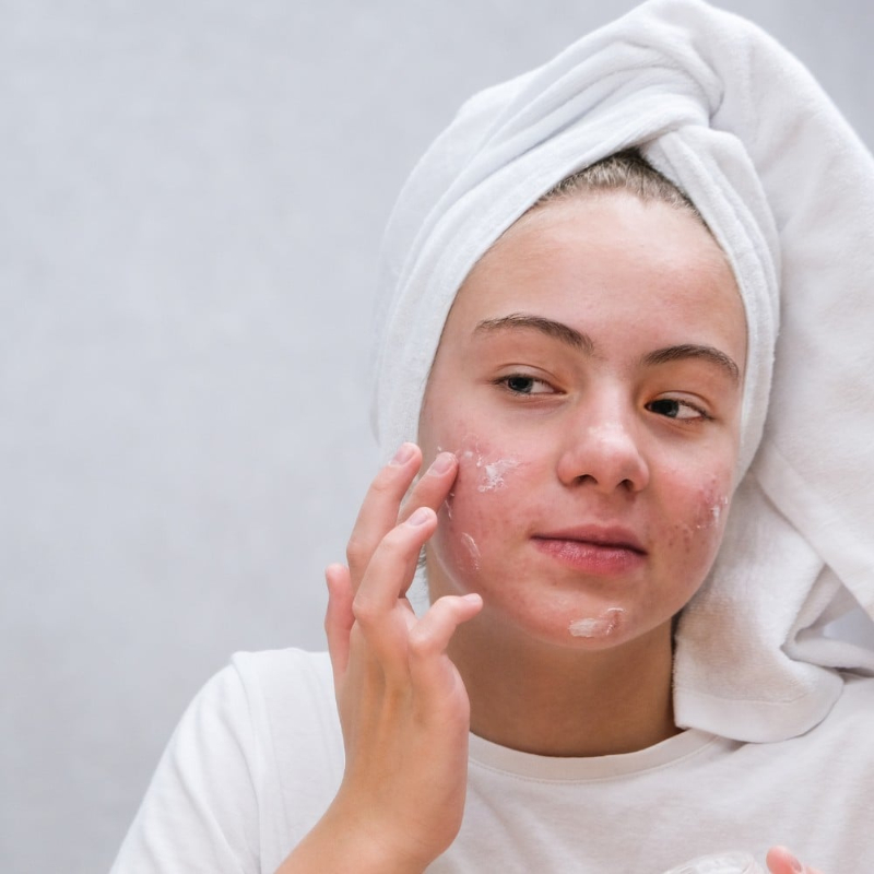 hướng dẫn cách bôi kem chống nắng cho da mụn