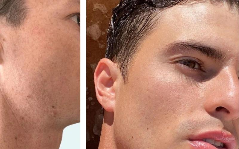 tác hại của việc không dùng kem chống nắng