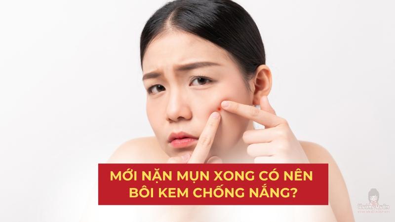 mới nặn mụn xong có nên bôi kem chống nắng
