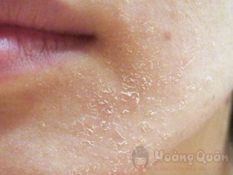 bôi kem chống nắng vón cục