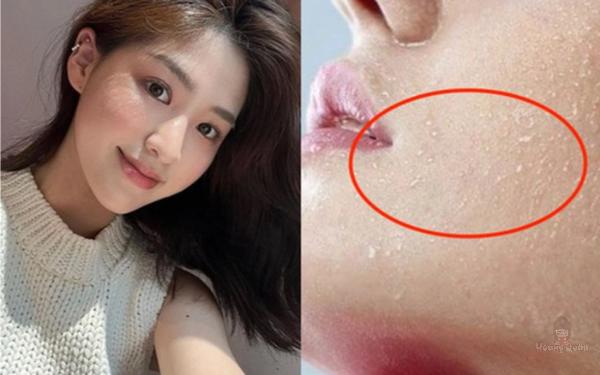 vì sao cần thoa kem chống nắng trong cả mùa đông