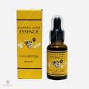 Serum Trị Mụn Hineko Manuka Acne Essence 30ml